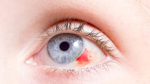 Poranění oka, vyšetření očí, celostní péče o zrak.
