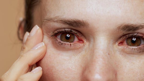 Zarudlé oči, nemoci očí, vyšetření očí, měření zraku, celostní péče o zrak.
